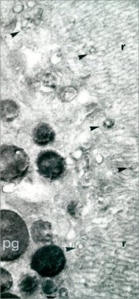 Localizing acetylcholine esterase - reaction product