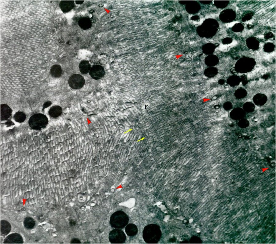 Rhabdom + AChE in vesicles