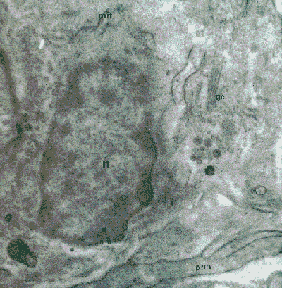 Lentigen cell - proximal