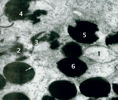 Opilio parietinus vacuoles/pigment granules